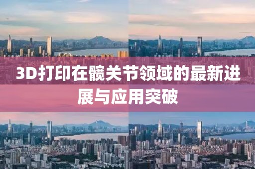 3D打印在髋关节领域的最新进展与应用突破